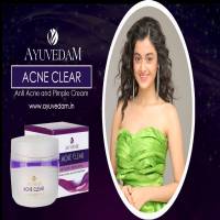 AYUVEDAM Acne Clear Anti Acne and Pimple Cream
